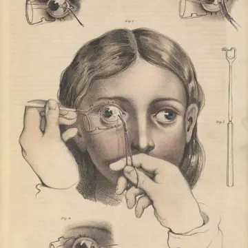 ΜΕΡΟΣ 3ο- Διακεκριμένοι ιατροί Πολιχνιάτες-Γεώργιος Κωστομοίρης