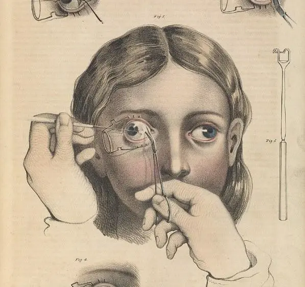 ofthalmiatros-xeirourgei ΜΕΡΟΣ 3ο- Διακεκριμένοι ιατροί Πολιχνιάτες: Γιατί όχι και οδός ΓΕΩΡΓΙΟΥ ΚΩΣΤΟΜΟΙΡΗ;